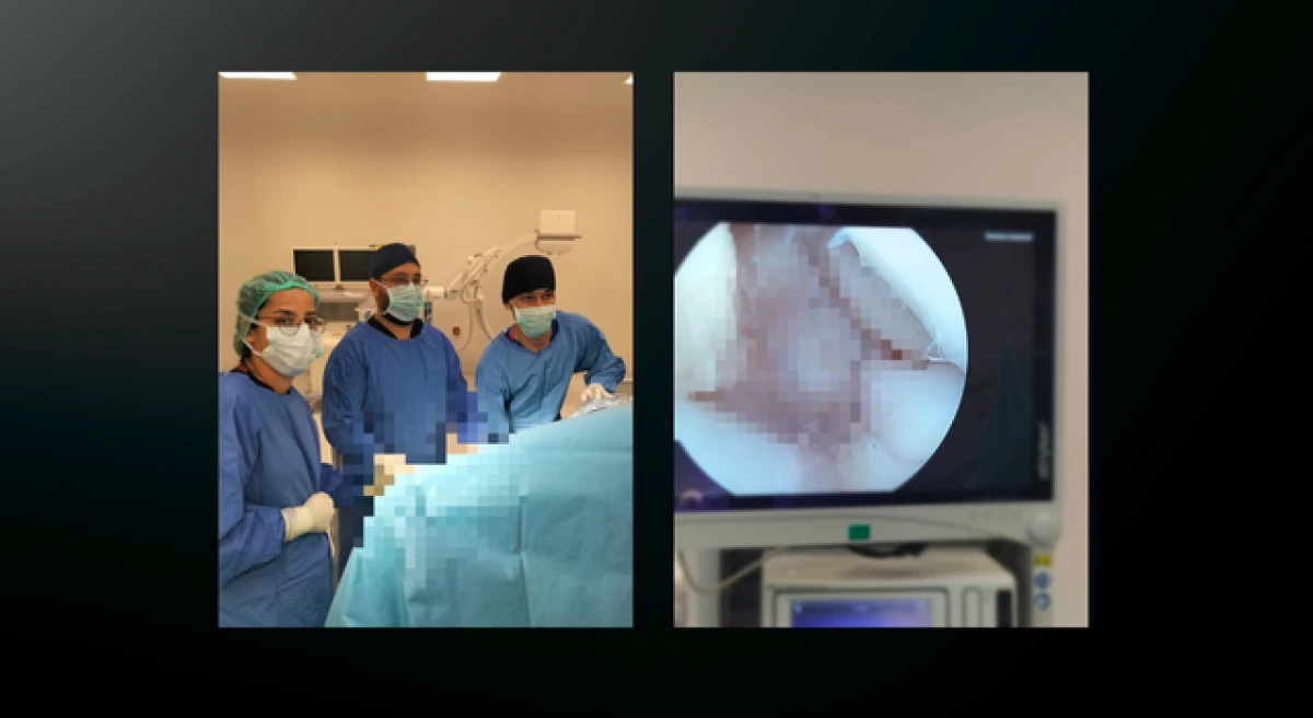 Çan Devlet Hastanesi’nde bir ilk!