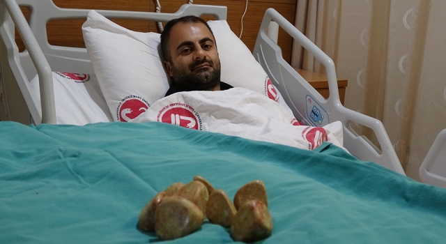 Çanakkale’de bir hastanın mesanesinden 550 gram ağırlığında 20 taş çıkarıldı